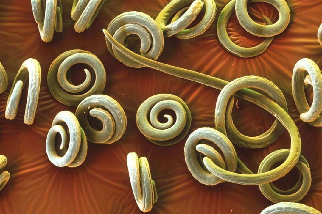 worm parasites gikan sa lawas sa tawo