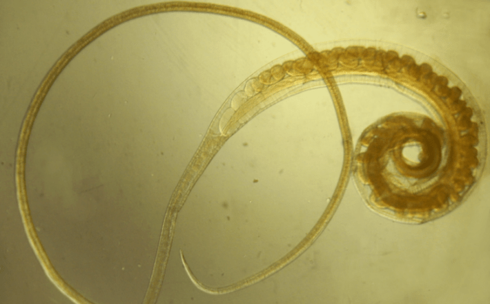 Human whipworm - usa ka helminth nga makaapekto sa mga tin-edyer