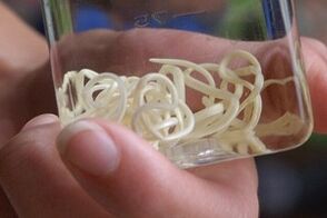 Mga Parasito gikan sa lawas sa tawo