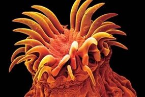 Trematode Parasite sa mga Tawo