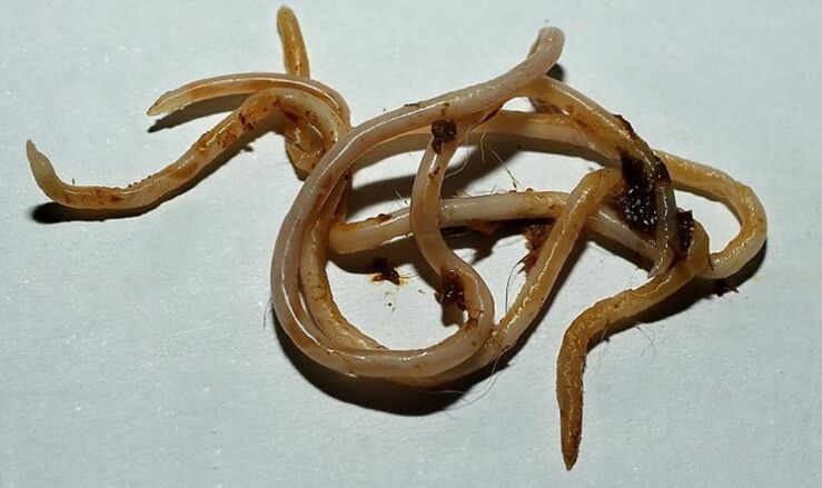 Toxocara gikan sa lawas sa tawo